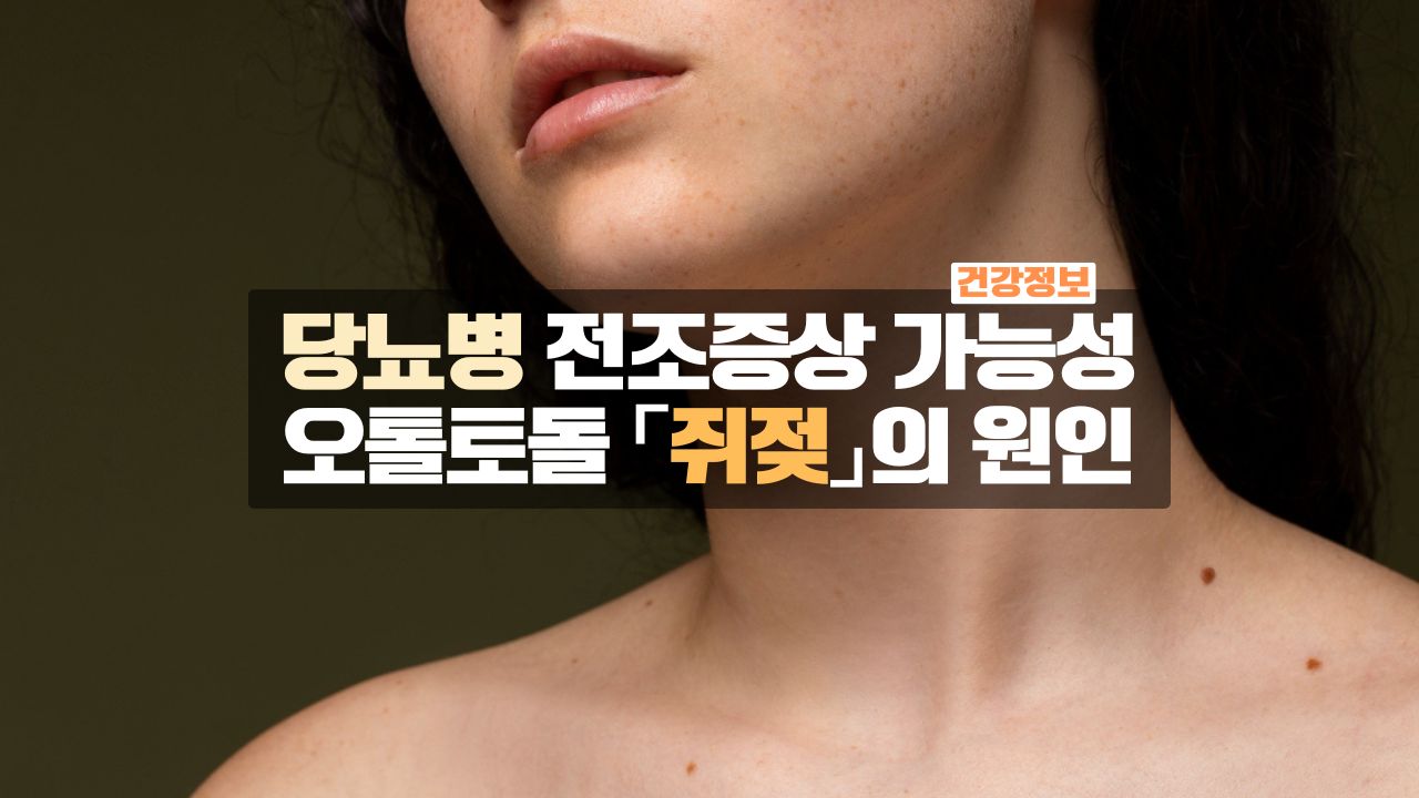 당뇨병 전조증상 쥐젖